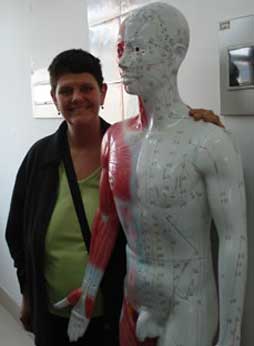 picture of Maria Mercati with acupuncture model